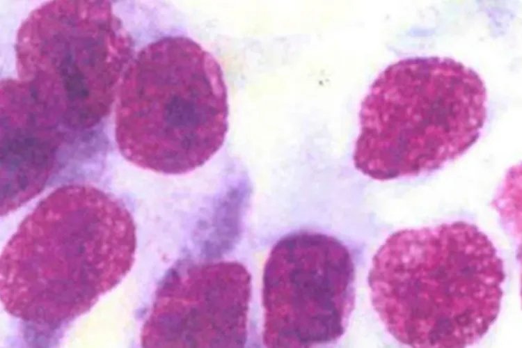 癌细胞真实图片