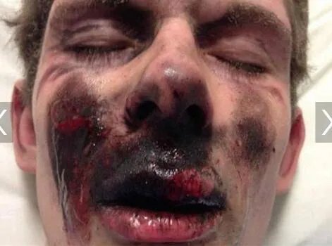 抽烟时香烟突爆炸 疑似内藏红色小鞭炮