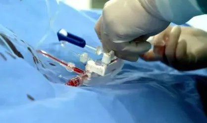 装支架就废了?北京安贞医院心内科专家带您走出误区!!