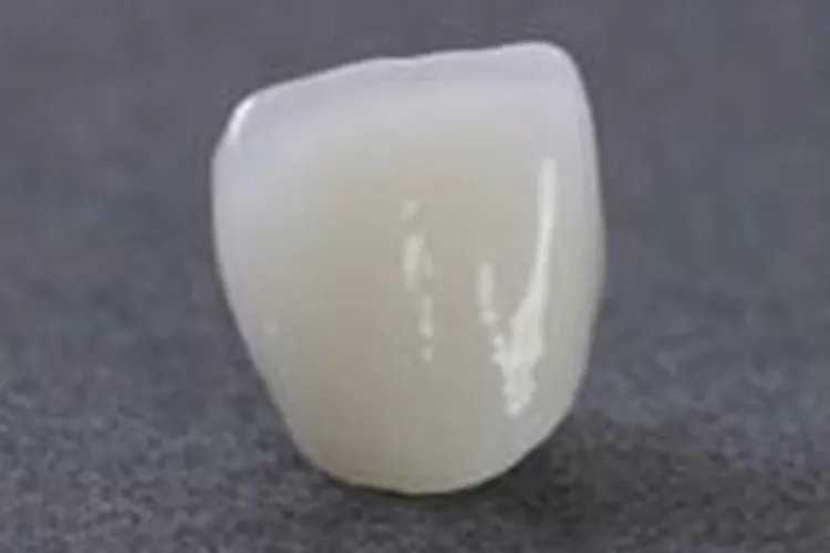 单颗牙套的图片