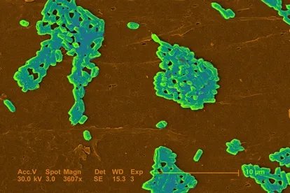 大肠杆菌在低倍镜下的图片