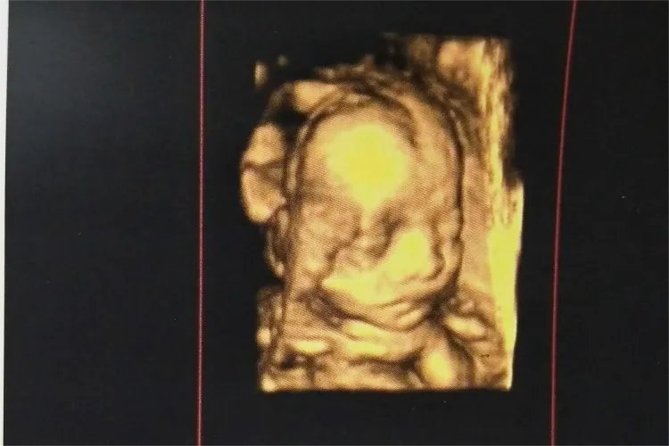 怀孕5个月胎儿真实图片