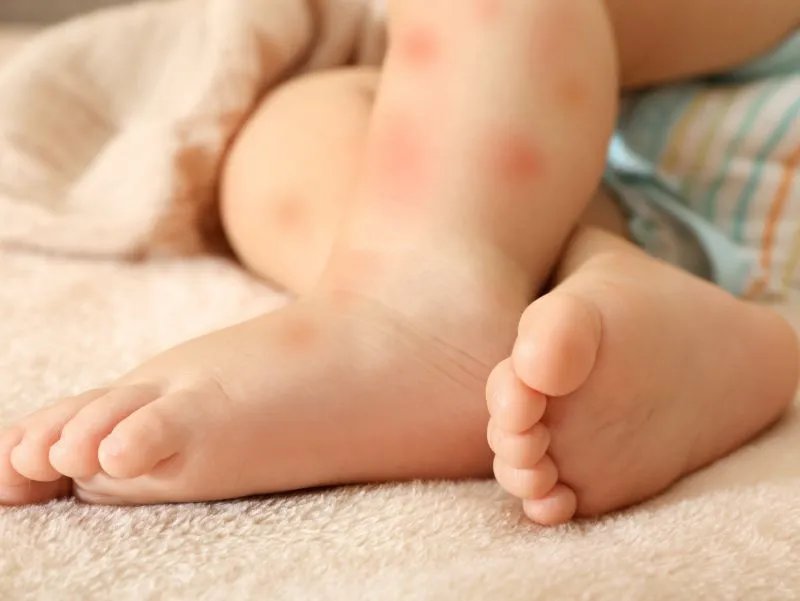 水解蛋白奶粉的优势