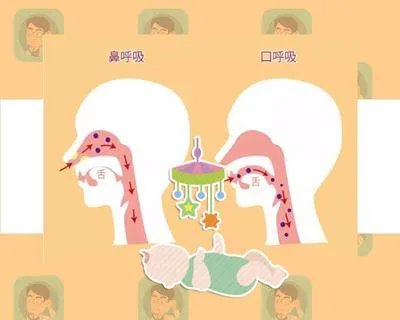 睡觉被亲妈用胶布封嘴?要知道,张嘴呼吸毁了可不仅是孩子颜值!