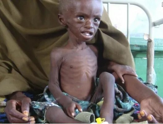 非洲四国遭遇饥荒,超2000万非洲人民将面临死亡