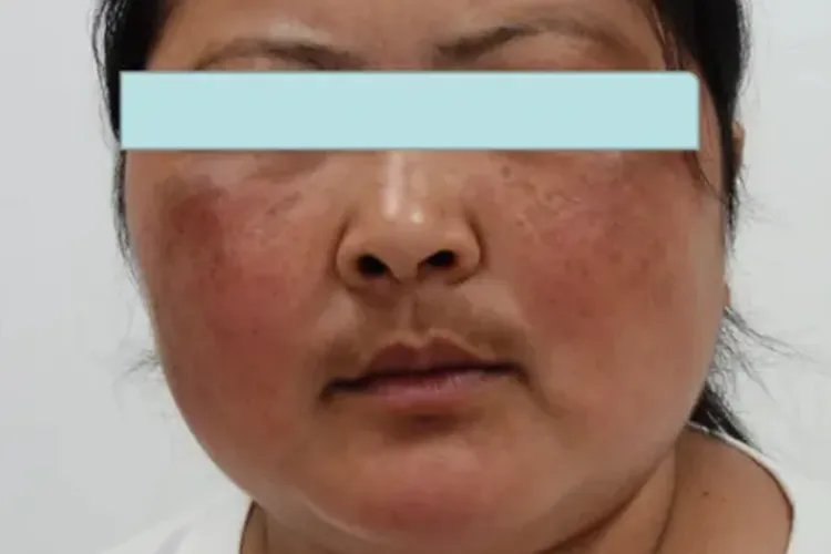 满月脸面容图片