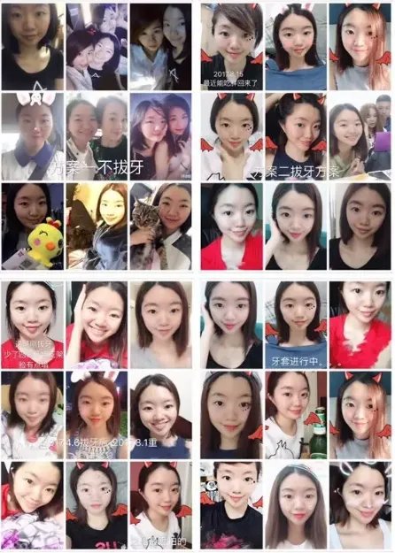 孙杨证明,牙齿正畸能让你变得更美!