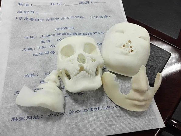 27岁女子换脸是怎么回事?