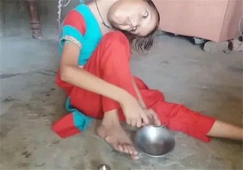 女孩头部无法竖立 被称为罪恶象征,村民害怕的瑟瑟发抖