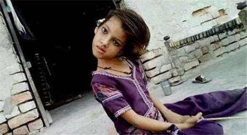 女孩头部无法竖立 被称为罪恶象征,村民害怕的瑟瑟发抖