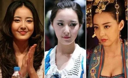 米露的男朋友叫什么名字 米露整容失败脸下垂