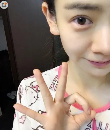 戚薇自拍报平安 大家放心我OK的