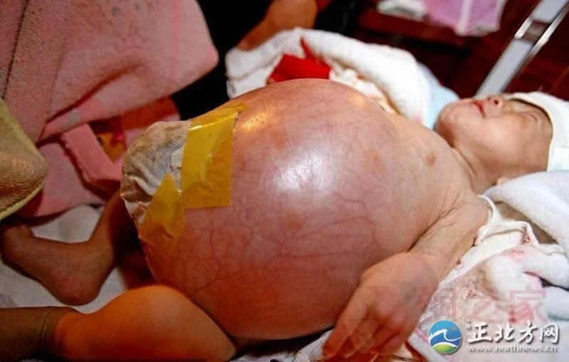 男子发现木乃伊猫 千年女木乃伊产下活婴