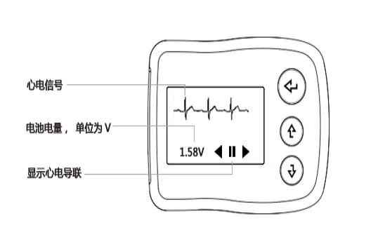 动态心电图十个贴片的位置图