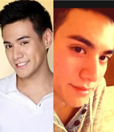 杜天皓整容前后对比照被曝 个性直率的“招黑体”