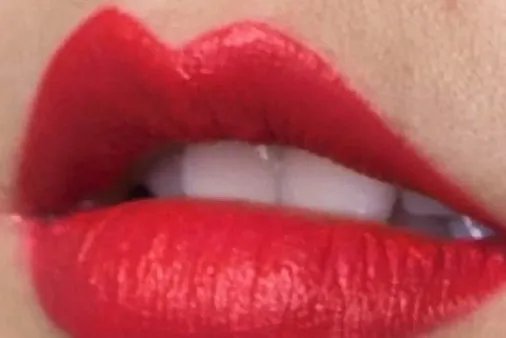 华山美容冠多少钱