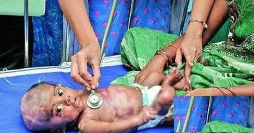 三月男婴身体无故自燃医生无解(图)