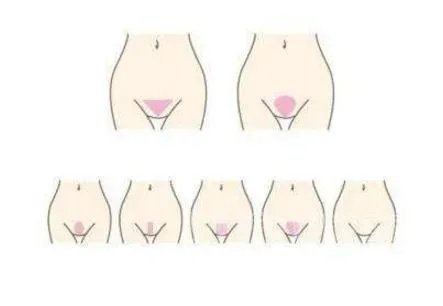 什么是维纳斯之丘：维纳斯之丘在哪里,维纳斯丘图片