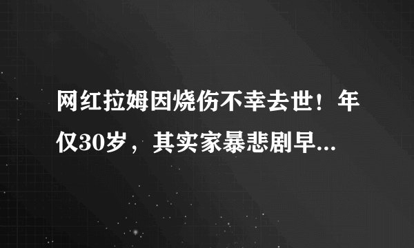 网红拉姆因烧伤不幸去世！年仅30岁，其实家暴悲剧早就有迹可循
