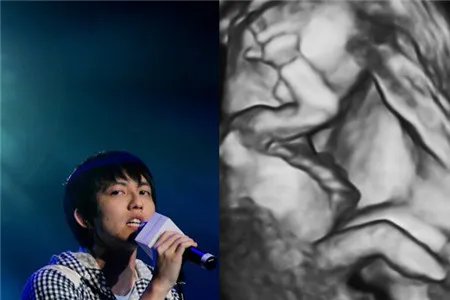 林宥嘉胎动初体验 大方分享婚后甜蜜生活