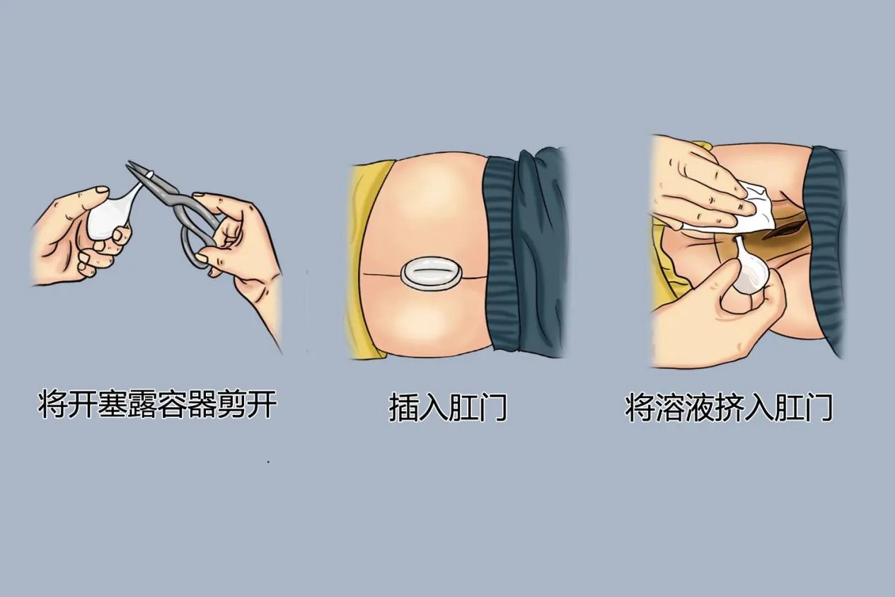 开塞露通便使用方法和姿势图片