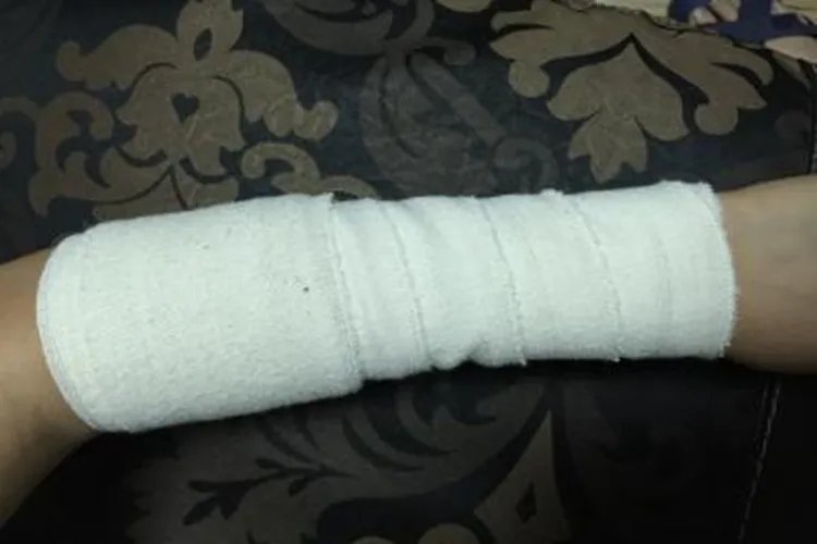 12种急救包扎方法图解