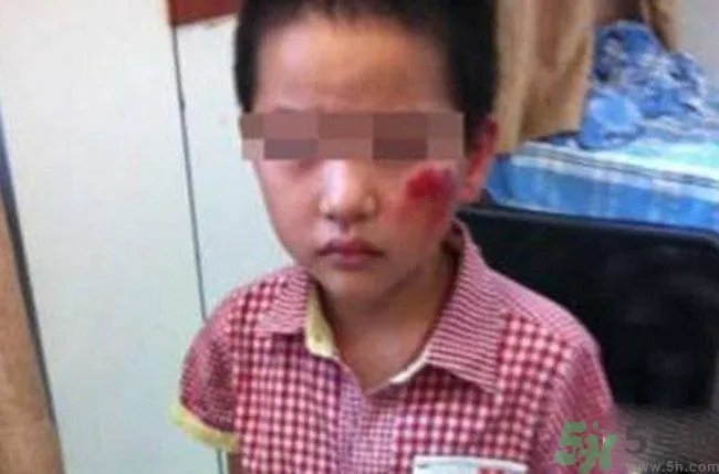 男孩遭校长暴打的结果是什么？男孩遭校长暴打的真相是什么？