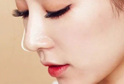 自体软骨隆鼻去什么医院