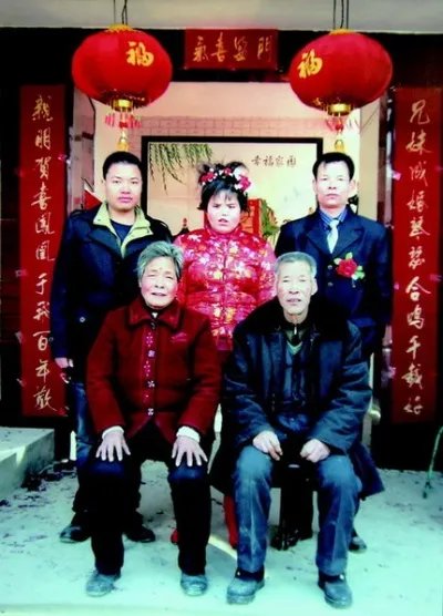 世界首例“坑面女”丑变美 演绎人间大爱的传递