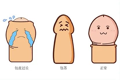 包皮过长图