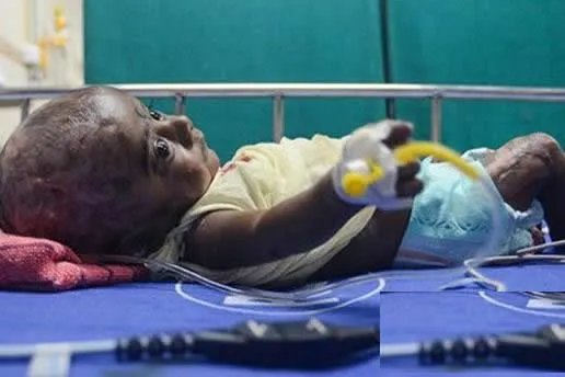 三月男婴身体无故自燃医生无解(图)