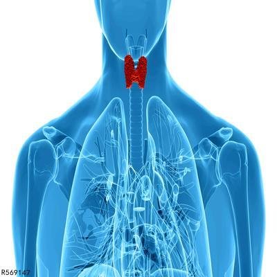甲状腺球蛋白抗体高是怎么回事