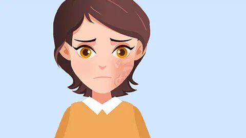 脸上皮肤暗黄毛孔粗大怎么办