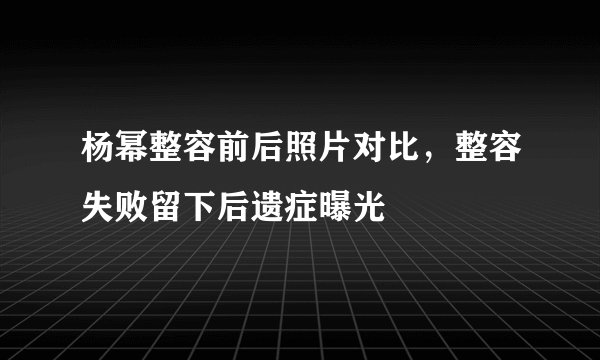 杨幂整容前后照片对比，整容失败留下后遗症曝光