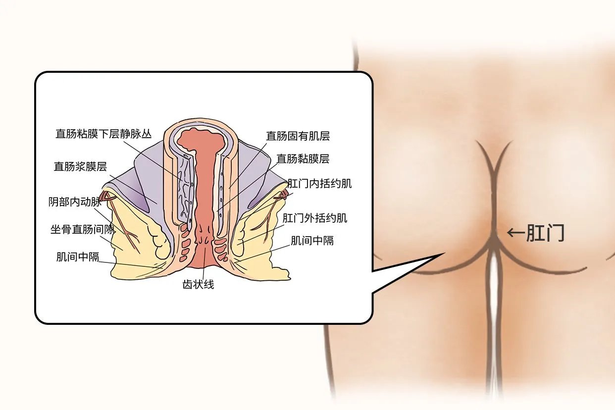 正常肛门和肛裂图片