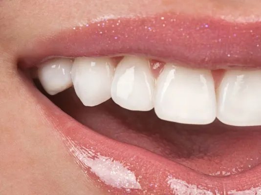 长智齿需要拔掉吗