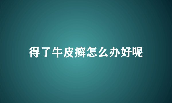 得了牛皮癣怎么办好呢