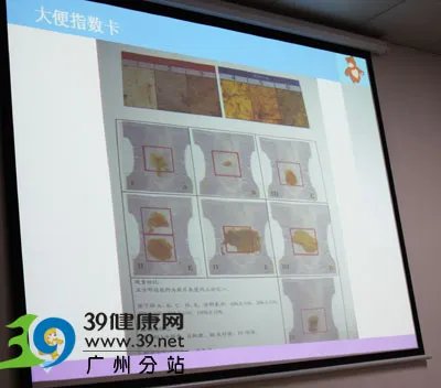 广州市妇女儿童医疗中心外科副主任医师钟微：宝宝黄疸持续不退 父母应警惕是胆道闭锁