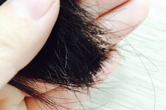 白头发会越拔越多吗