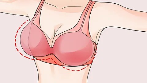 副乳增生是什么原因引起的