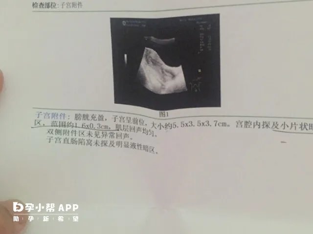 前3个月最准怀男孩的九个征兆,从孕囊形状、肚型能准确看出