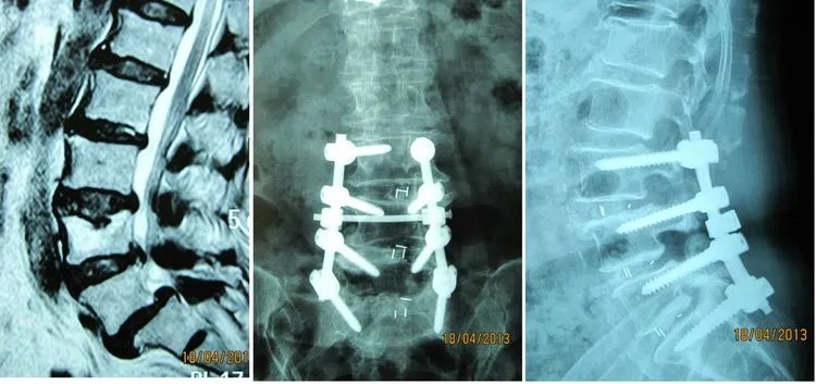 郑州市骨科医院脊柱二科科室简介