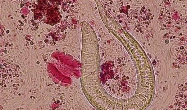 玉米男孩原型是谁 玉米男孩图片及案例描述