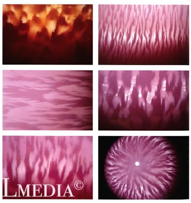 海螺珠是什么？和珍珠有什么区别？