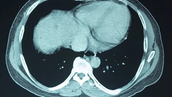 脑膜炎症状有哪些