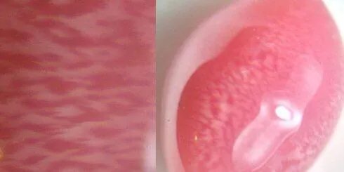 海螺珠是什么？和珍珠有什么区别？