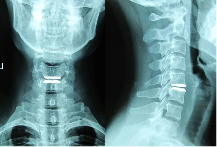 郑州市骨科医院脊柱二科科室简介