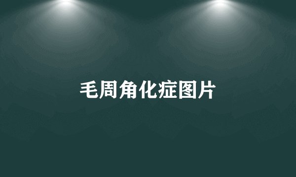 毛周角化症图片