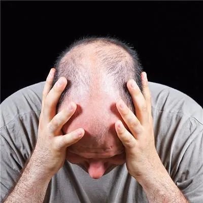 肾囊肿如何治疗