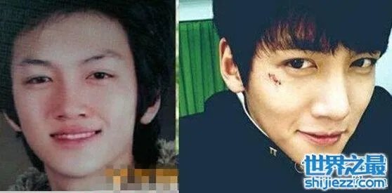 池昌旭整容前后照片对比，整容前也是一名花美男 